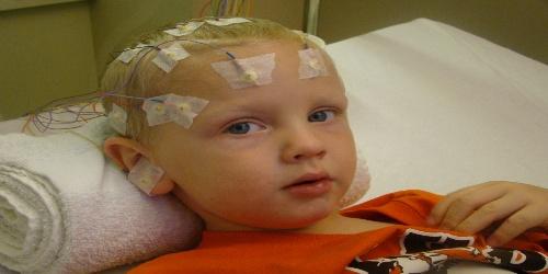Bebeklerde EEG Nasýl Çekilir?