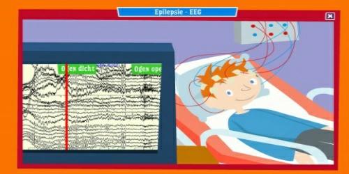 EEG Nedir?