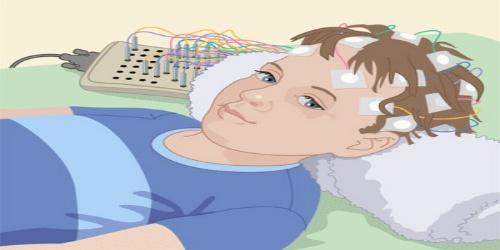 EEG Çeþitleri